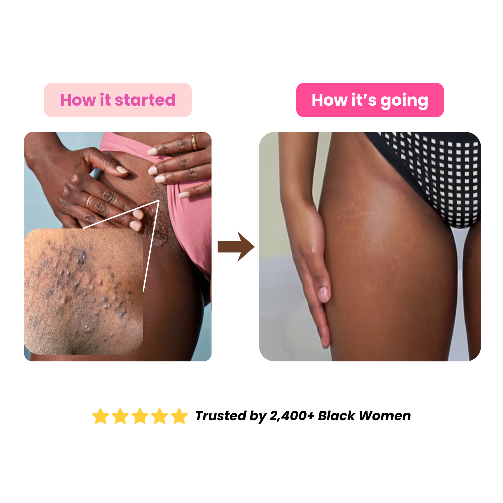 The Glowelle 2-in-1 Trimmer